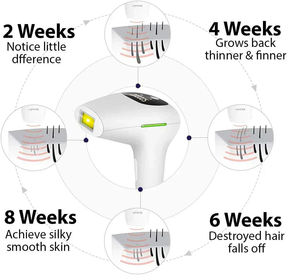 💎 Premium IPL Hair Removal Devices – At-Home Beauty with Professional Results! ✨ 30% off